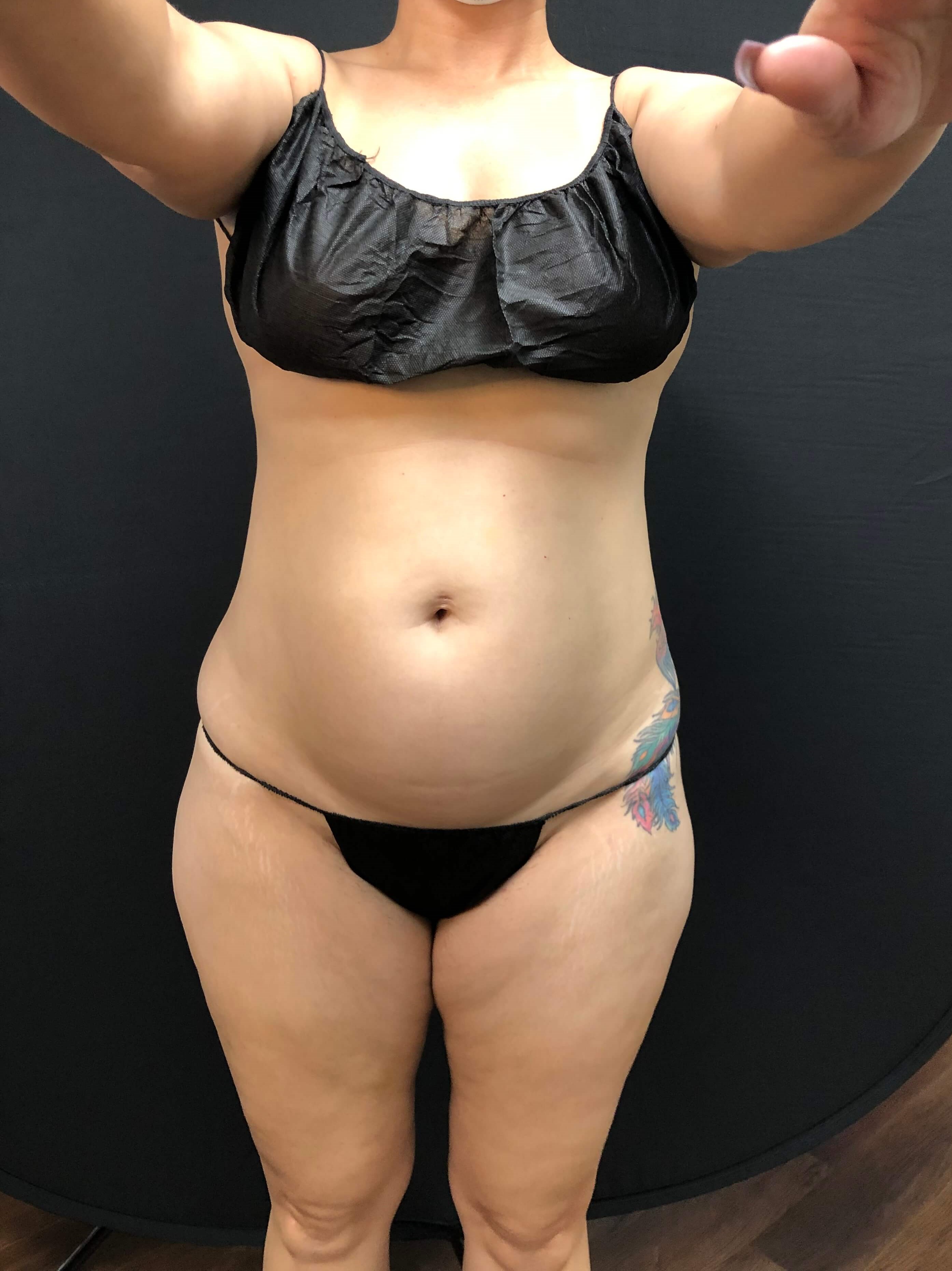 No longer sucking it in!! Before