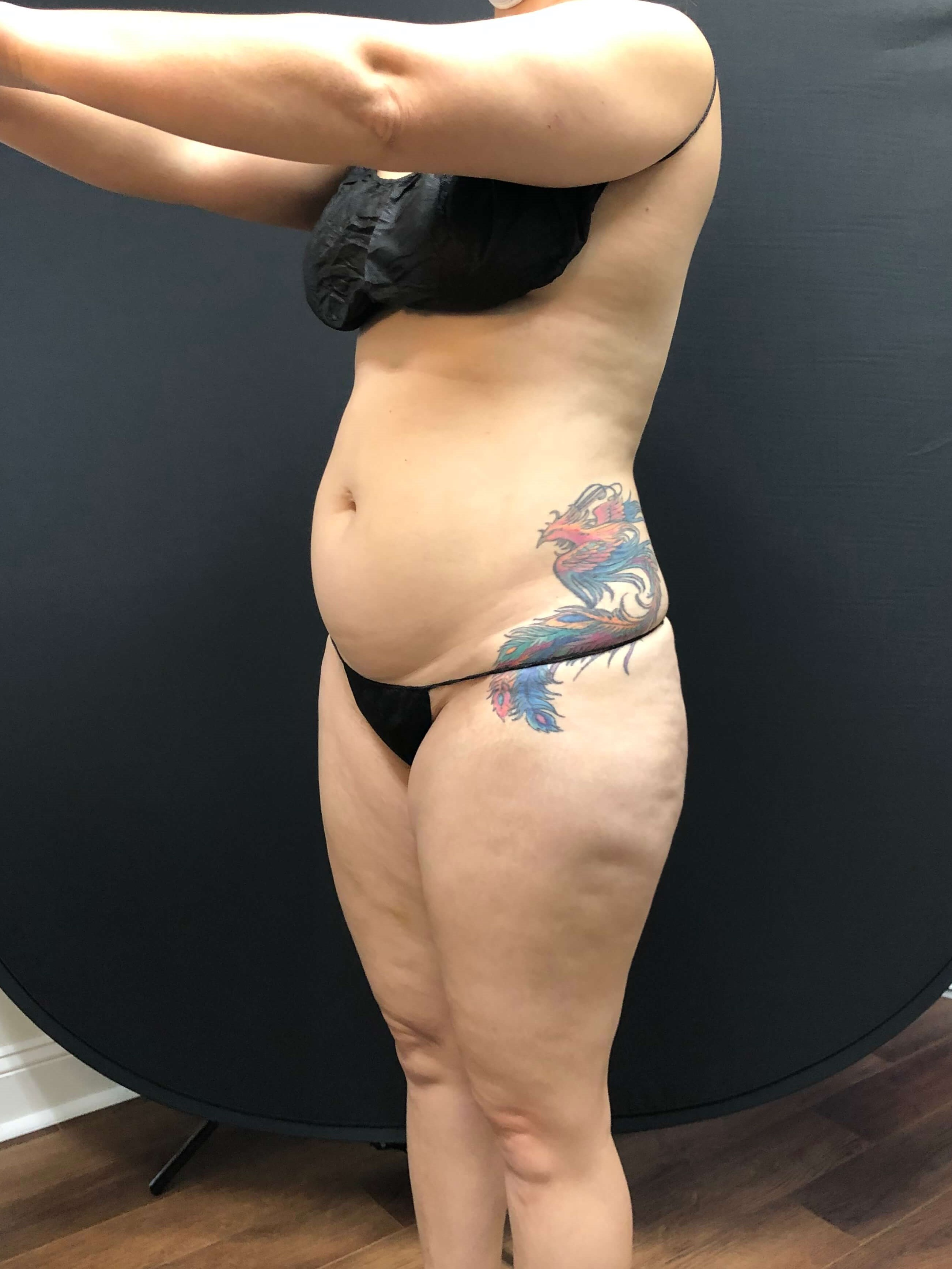 No longer sucking it in!! Before