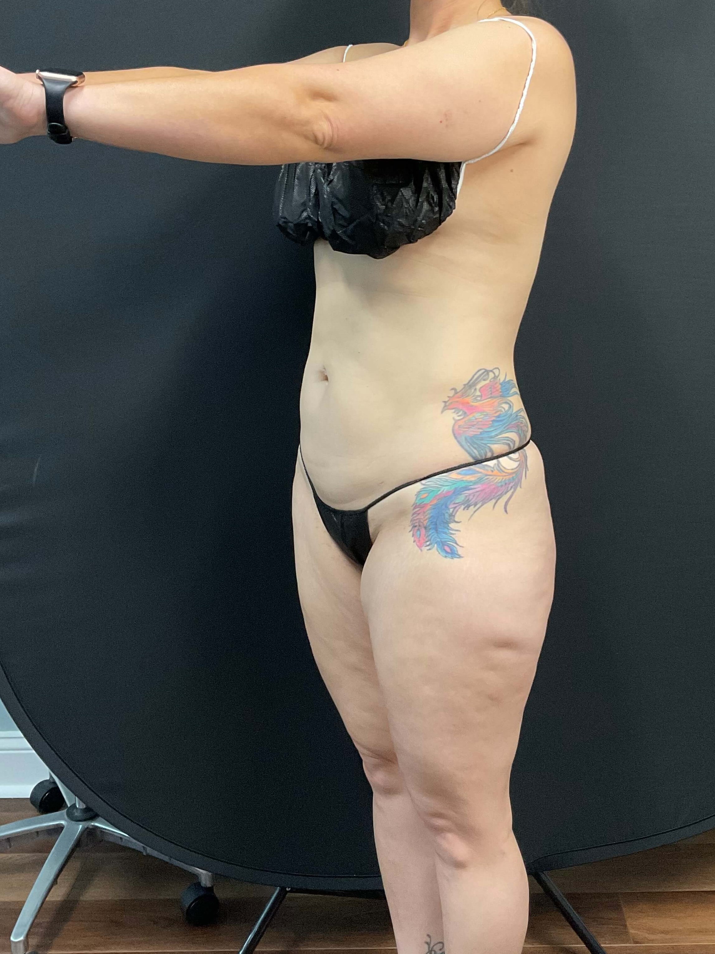 No longer sucking it in!! After