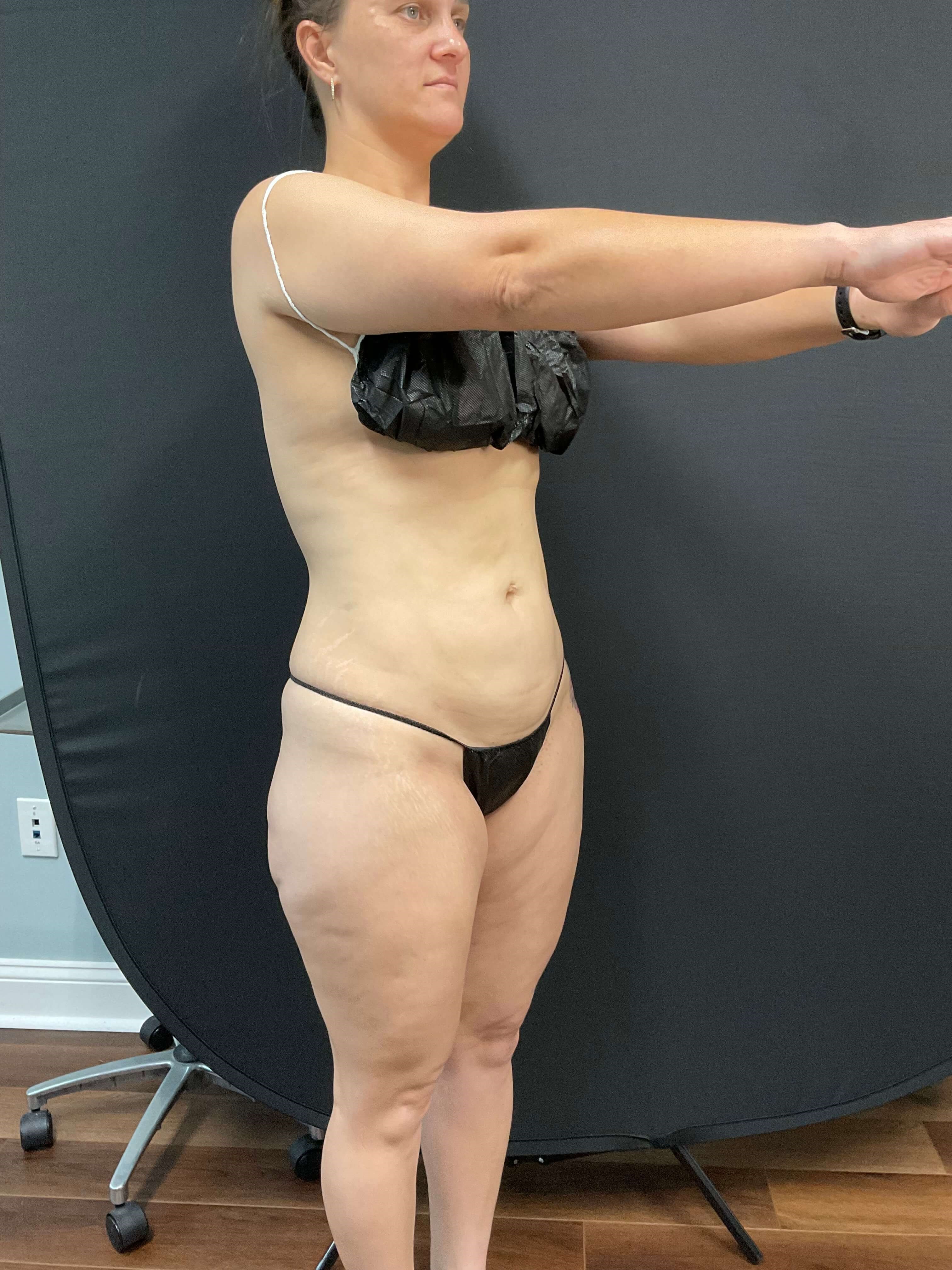 No longer sucking it in!! After