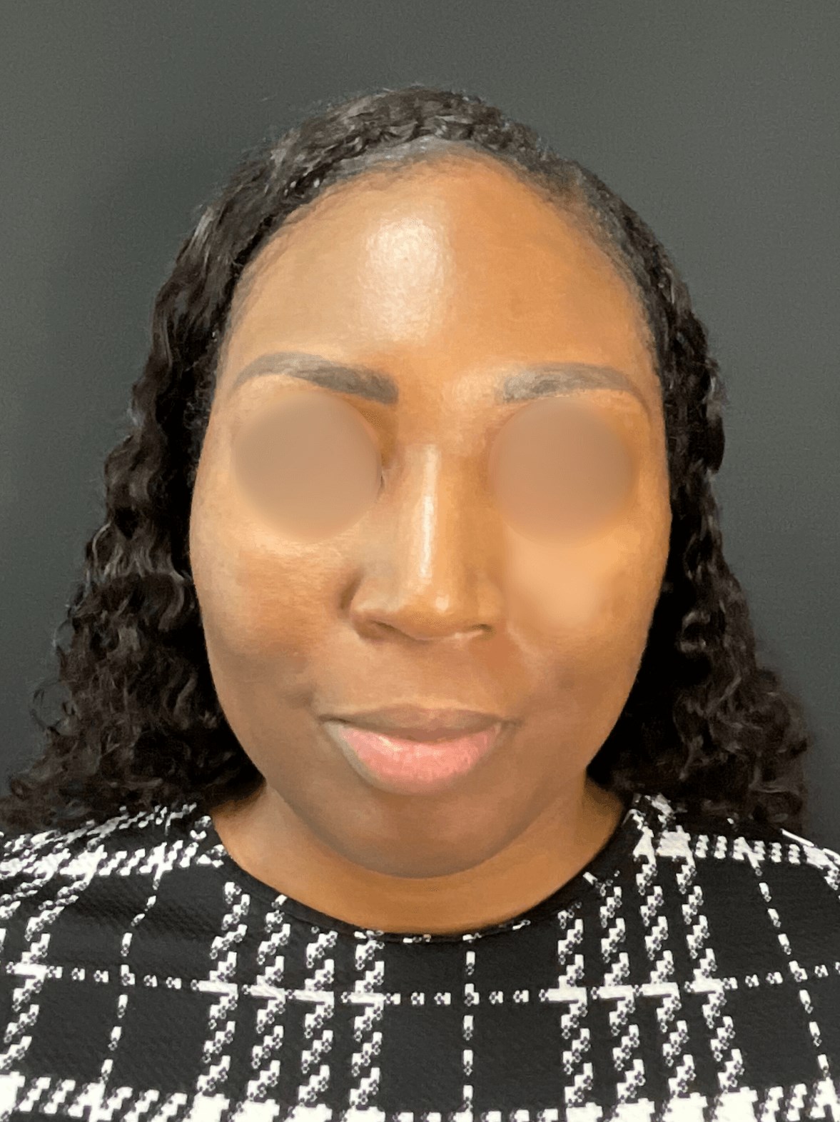 Beautiful Brown Skin - Front After