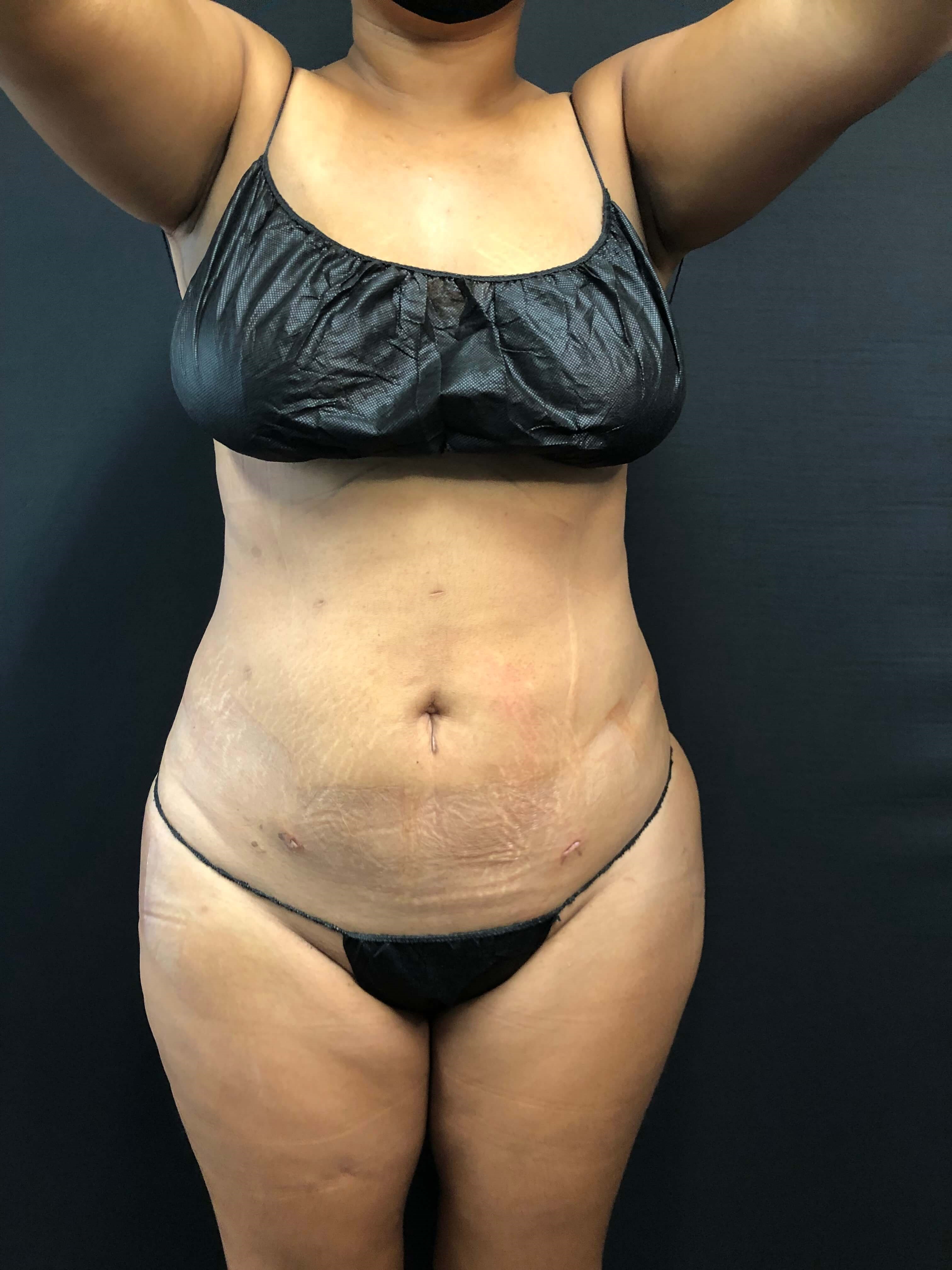 Brains & BOOTY with Beautifill After