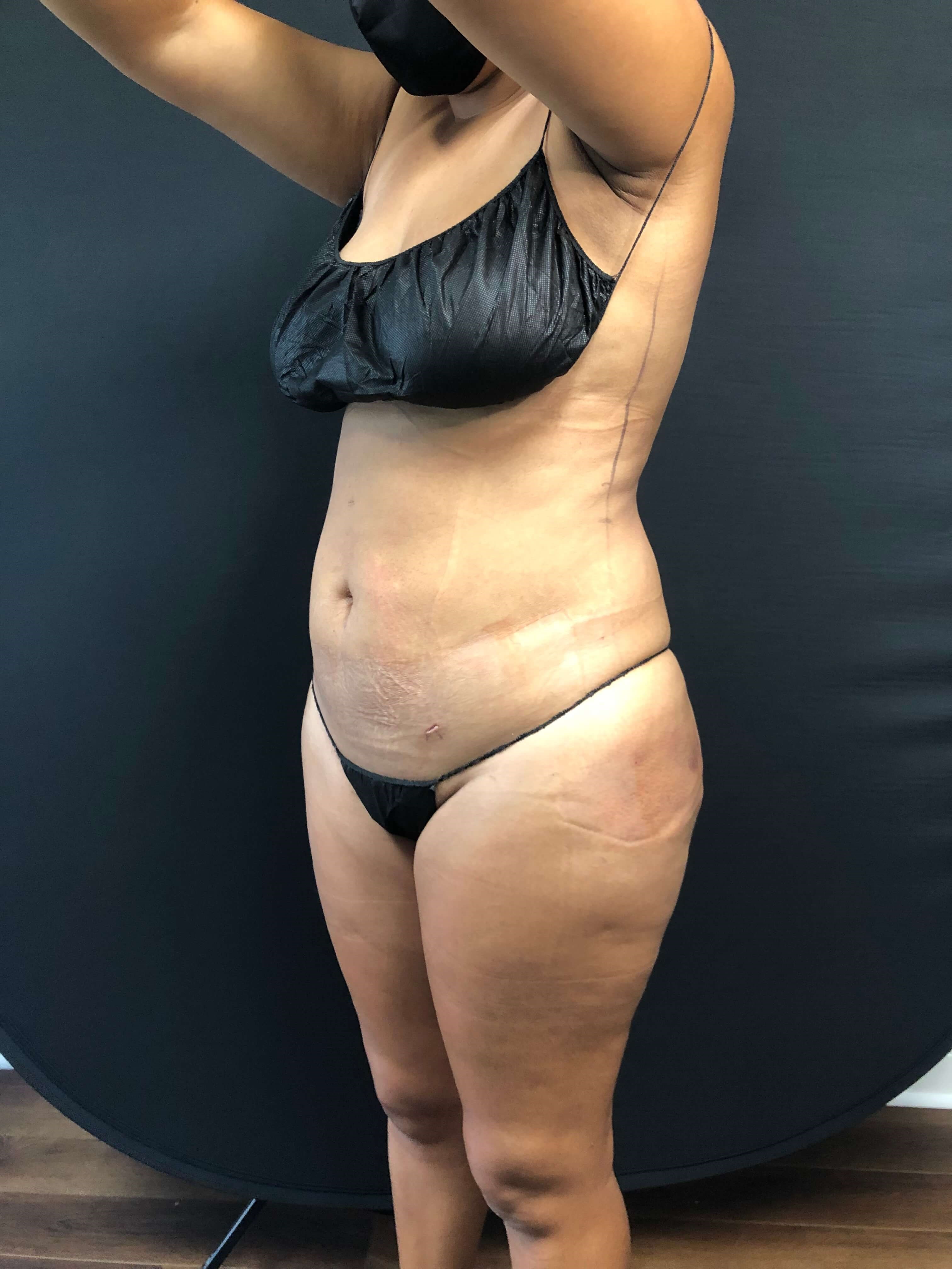 Brains & BOOTY with Beautifill After