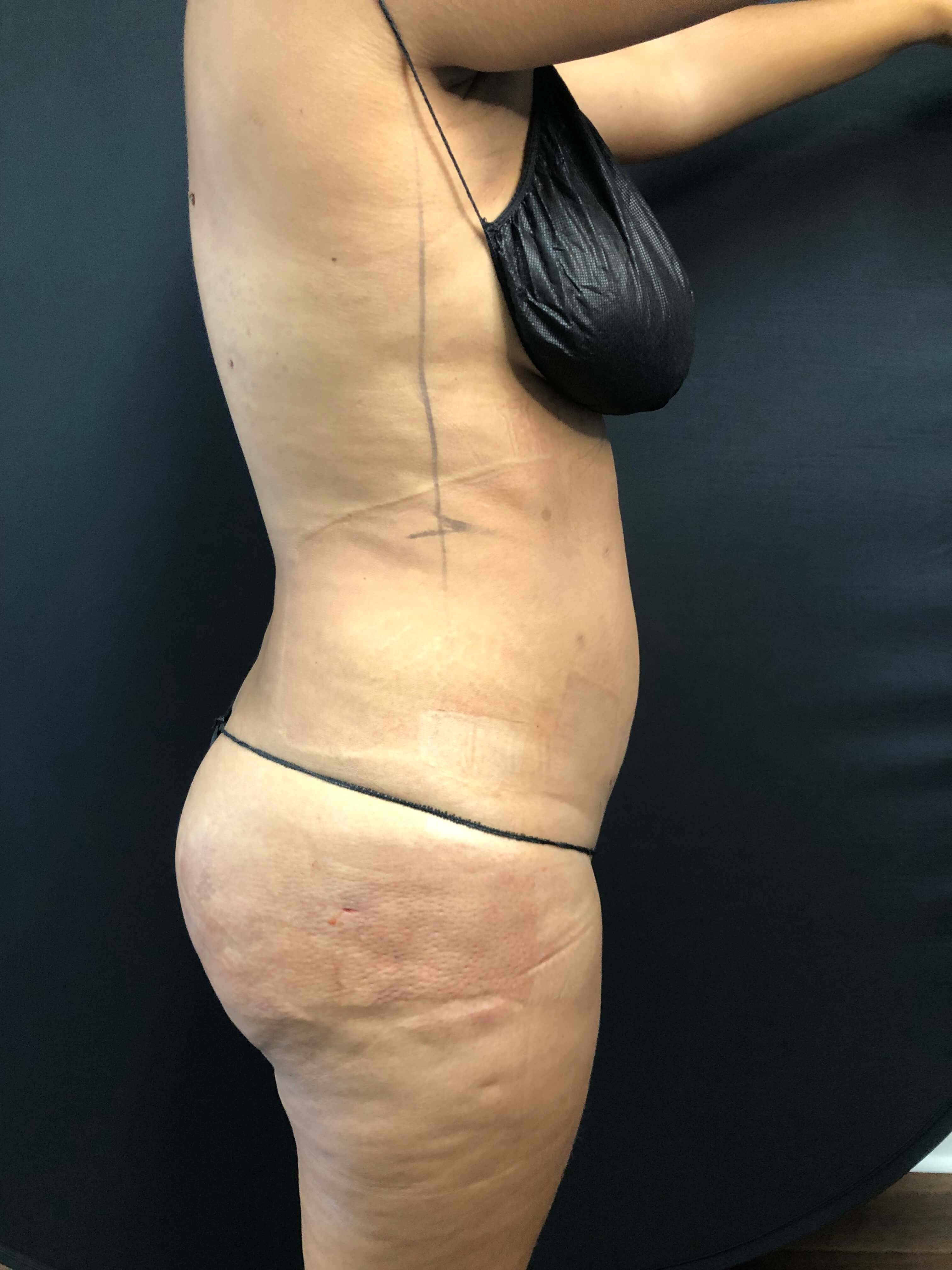 Brains & BOOTY with Beautifill After